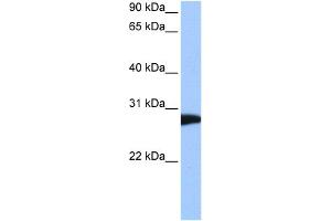 WB Suggested Anti-NSF Antibody Titration:  0.