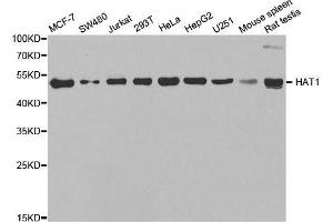 Western blot analysis of extracts of various cell lines, using HAT1 antibody. (HAT1 抗体  (AA 245-419))
