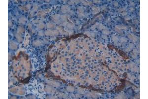 DAB staining on IHC-P; Samples: Rat Pancreas Tissue (Vip 抗体  (AA 34-157))