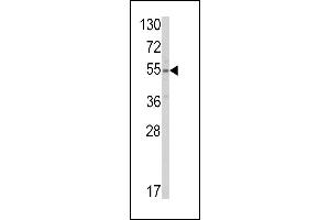 Western blot analysis of SLC38A3 Antibody (Center) (ABIN390795 and ABIN2841042) in HepG2 cell line lysates (35 μg/lane).