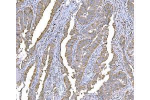 IHC analysis of SND1 using anti-SND1 antibody (ABIN7600526). (SND1 抗体  (AA 20-204))