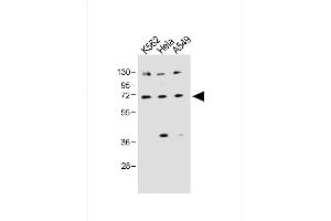 All lanes : Anti-SLC22A4 Antibody (C-term) at 1:1000 dilution Lane 1: K562 whole cell lysate Lane 2: Hela whole cell lysate Lane 3: A549 whole cell lysate Lysates/proteins at 20 μg per lane. (SLC22A4 抗体  (C-Term))