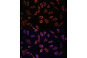 Immunofluorescence analysis of L929 cells using CYTH1 antibody (ABIN7266661) at dilution of 1:100. (Cytohesin 1 抗体  (AA 1-70))