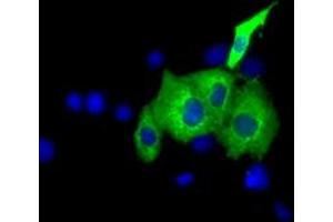 Image no. 1 for anti-Insulin-Like Growth Factor 2 mRNA Binding Protein 2 (IGF2BP2) antibody (ABIN1498822) (IGF2BP2 抗体)