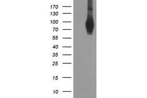 Western Blotting (WB) image for anti-phosphodiesterase 4B, cAMP-Specific (PDE4B) antibody (ABIN1500093) (PDE4B 抗体)