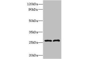 Western blot All lanes: FAM71C antibody at 6 μg/mL Lane 1: 293T whole cell lysate Lane 2: Jurkat whole cell lysate Secondary Goat polyclonal to rabbit IgG at 1/10000 dilution Predicted band size: 28 kDa Observed band size: 28 kDa (FAM71C 抗体  (AA 1-241))
