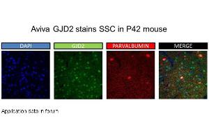 Image no. 2 for anti-Gap Junction Protein, delta 2, 36kDa (GJD2) (Middle Region) antibody (ABIN2774866) (GJD2 抗体  (Middle Region))