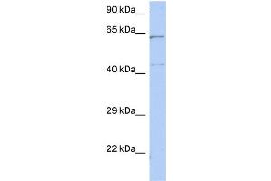 WB Suggested Anti-EME1 Antibody Titration: 0. (Crossover junction endonuclease EME1 (EME1) (Middle Region) 抗体)