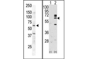 Image no. 2 for anti-RYK Receptor-Like Tyrosine Kinase (RYK) (AA 150-200) antibody (ABIN359937) (RYK 抗体  (AA 150-200))