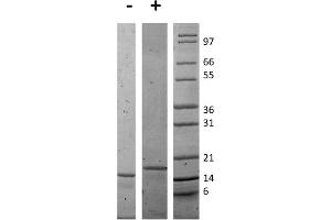 SDS-PAGE of Mouse Interleukin-16 Recombinant Protein SDS-PAGE of Mouse Interleukin-16 Recombinant Protein. (IL16 蛋白)