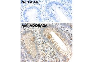 Immunohistochemistry (IHC) image for anti-Adenosine A2a Receptor (ADORA2A) (C-Term) antibody (ABIN7272985) (Adenosine A2a Receptor 抗体  (C-Term))