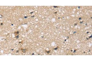 Immunohistochemistry of paraffin-embedded Human brain tissue using SEMA4A Polyclonal Antibody at dilution 1:45 (Sema4a 抗体)