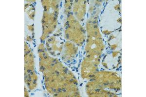 Immunohistochemistry of paraffin-embedded human stomach using CYP2B6 antibody (ABIN5997556) at dilution of 1/100 (40x lens). (CYP2B6 抗体)
