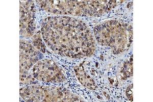 IHC analysis of FEN1 using anti-FEN1 antibody (ABIN7601619).