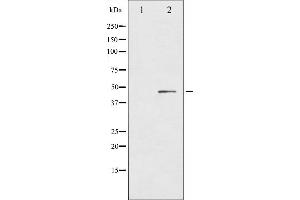 Western Blotting (WB) image for anti-Chemokine (C-X-C Motif) Receptor 2 (CXCR2) (pSer347) antibody (ABIN6256283)