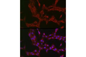 Immunofluorescence analysis of PC-12 cells using NKIR Rabbit pAb (ABIN7268903) at dilution of 1:100 (40x lens). (NKIRAS1 抗体  (AA 118-192))