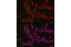 Immunofluorescence analysis of PC-12 cells using NKIR Rabbit pAb (ABIN7268903) at dilution of 1:100 (40x lens). (NKIRAS1 抗体  (AA 118-192))