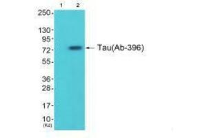 Western blot analysis of extracts from 293 cells (Lane 2), using Tau (Ab-396) antiobdy. (MAPT 抗体  (Ser396))