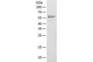 Western Blotting (WB) image for Alveolar Soft Part Sarcoma Chromosome Region, Candidate 1 (ASPSCR1) (AA 1-553) protein (His tag) (ABIN7121804) (ASPSCR1 Protein (AA 1-553) (His tag))