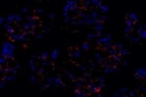 Immunofluorescent analysis of paraformaldehyde-fixed human placenta using PTGFR (ABIN7075209) at dilution of 1: 800 (PTGFR 抗体)