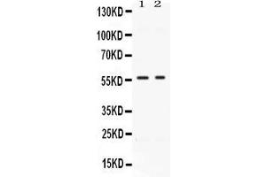 Western blot analysis of BMP15 expression in HELA whole cell lysates ( Lane 1) and MCF-7 whole cell lysates ( Lane 2). (BMP15 抗体  (AA 268-392))