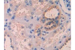 Immunohistochemistry (IHC) image for anti-Interleukin 1 Receptor Accessory Protein (IL1RAP) (AA 420-558) antibody (ABIN7438568)
