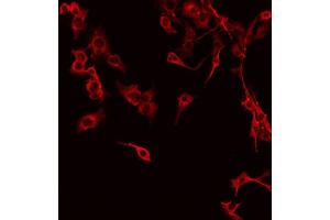 ABIN6267341 staining NIH-3T3 by IF/ICC. (c-MET 抗体  (pTyr1234))