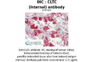 Image no. 2 for anti-Clathrin Heavy Chain (CLTC) (C-Term), (Internal Region) antibody (ABIN1733162) (Clathrin Heavy Chain (CLTC) (C-Term), (Internal Region) 抗体)