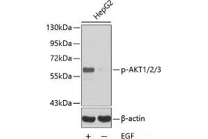 Western blot analysis of extracts HepG2 cells using Phospho-AKT1(Y315)/AKT2(Y316)/AKT3(Y312) Polyclonal Antibody.