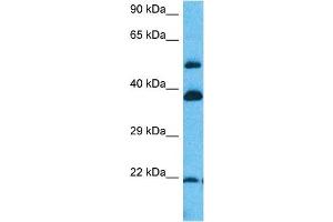 Host:  Rabbit  Target Name:  ERI1  Sample Tissue:  Human Lung Tumor lysates  Antibody Dilution:  1ug/ml (ERI1 抗体  (N-Term))