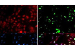 Immunofluorescence analysis of GFP-RNF168 transgenic U2OS cells using POLK Polyclonal Antibody (POLK 抗体)