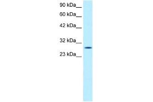 RGS16 antibody used at 1 ug/ml to detect target protein. (RGS16 抗体  (C-Term))