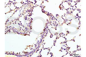 Lane 1: rat brain lysates Lane 2: human colon carcinoma lysates probed with Anti VIP Receptor 1/VAPC1 Polyclonal Antibody, Unconjugated (ABIN872880) at 1:200 in 4 °C. (VIPR1 抗体  (AA 351-457))