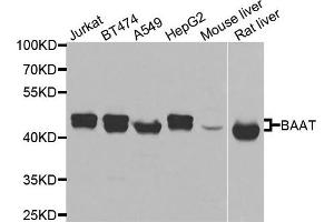 Western blot analysis of extracts of various cells, using BAAT antibody. (BAAT 抗体)
