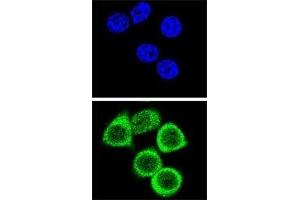 Confocal immunofluorescent analysis of PARP antibody with HeLa cells followed by Alexa Fluor 488-conjugated goat anti-rabbit lgG (green). (PARP1 抗体  (AA 183-214))