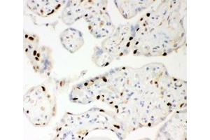 IHC-P: PARP antibody testing of human placenta tissue (PARP1 抗体  (AA 670-858))