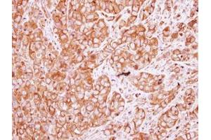Image no. 1 for anti-Nicotinic Acetylcholine Receptor beta (CHRNB1) (AA 274-501) antibody (ABIN1497506) (CHRNB1 抗体  (AA 274-501))