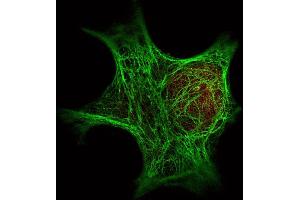 Immunofluorescence Microscopy of  Immunochemical's Anti-Keratin antibody () was used with  Dylight 488 goat anti-mouse 610-141-121 (shown in green) to detect Keratin by Immunofluorescence. (Keratin 6C 抗体)