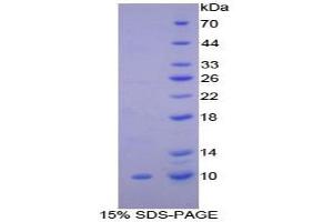 SDS-PAGE analysis of Rat Clara Cell Protein 16 Protein. (SCGB1A1 蛋白)