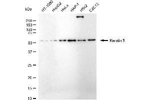 Western blotting analysis using Keratin 5 antibody (ABIN7799181).