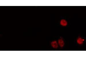 ABIN6274168 staining HeLa cells by IF/ICC. (MYF5 抗体  (N-Term))