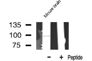 Western blot analysis of LTK expression in Mouse Brain lysate (LTK 抗体  (Internal Region))