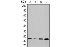 Western blot analysis of CHIP expression in Hela (A), PC12 (B), COS7 (C), mouse liver (D) whole cell lysates. (STUB1 抗体)