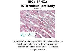Image no. 1 for anti-Epoxide Hydrolase 2, Cytoplasmic (EPHX2) (C-Term) antibody (ABIN1734088) (EPHX2 抗体  (C-Term))