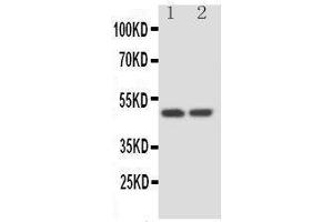 Anti-Kallistatin antibody, Western blotting Lane 1: HELA Cell Lysate Lane 2: SKOV Cell Lysate (SERPINA4 抗体  (C-Term))