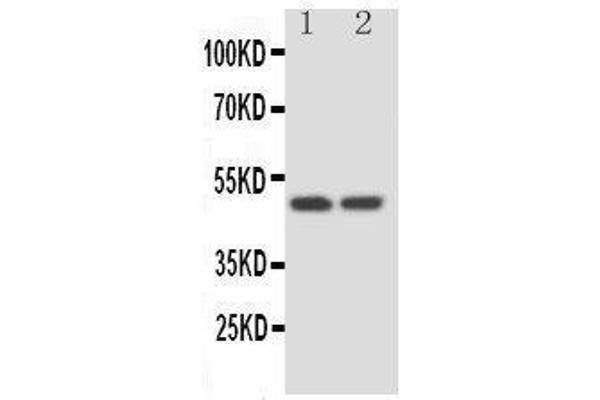 SERPINA4 antibody  (C-Term)