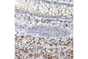 Immunohistochemistry (IHC) image for anti-B-Cell CLL/lymphoma 2 (BCL2) antibody (ABIN7265810)
