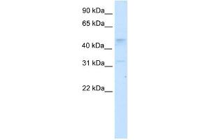 Western Blotting (WB) image for anti-Transcription Factor AP-2 gamma (Activating Enhancer Binding Protein 2 Gamma) (TFAP2C) (N-Term) antibody (ABIN2778628)