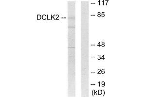 Western Blotting (WB) image for anti-Doublecortin-Like Kinase 2 (DCLK2) (N-Term) antibody (ABIN1849774) (DCLK2 抗体  (N-Term))