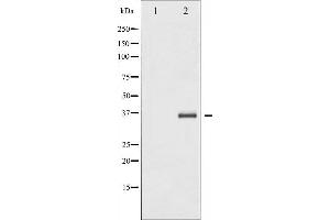 Western blot analysis of IkappaB-beta expression in TNF treated NIH-3T3 whole cell lysates,The lane on the left is treated with the antigen-specific peptide. (NFKBIB 抗体  (N-Term))
